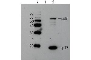 Western Blotting (WB) image for anti-Human Immunodeficiency Virus 1 Matrix (HIV-1 p17) (full length) antibody (ABIN2452017) (HIV-1 p17 antibody  (full length))