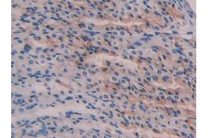 Used in DAB staining on fromalin fixed paraffin- embedded stomach tissue (Reelin antibody  (AA 2400-2610))