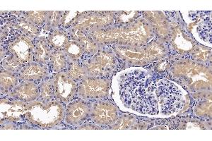 Detection of ANXA3 in Human Kidney Tissue using Monoclonal Antibody to Annexin A3 (ANXA3) (Annexin A3 antibody  (AA 190-312))