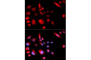 Immunofluorescence analysis of U2OS cells using KIF2C antibody (ABIN5973166). (KIF2C antibody)