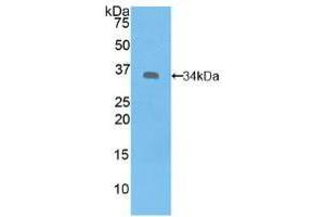 Western blot analysis of recombinant Human SYK. (SYK antibody  (AA 374-635))