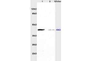 Lane 1: rat brain lysates Lane 2: rat heart lysates probed with Anti CK II alpha/STKPolyclonal Antibody, Unconjugated (ABIN731978) at 1:200 in 4 °C. (CSNK2A1/CK II alpha antibody  (AA 201-300))