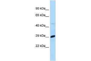 WB Suggested Anti-Mxd1 Antibody Titration: 1.