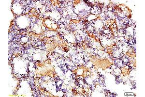 Formalin-fixed and paraffin embedded rat liver tissue with Anti-Collagen IV Polyclonal Antibody, Unconjugated (ABIN728413) at 1:200, followed by conjugation to the secondary antibody and DAB staining (Collagen IV antibody  (AA 1401-1500))