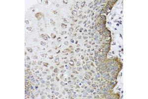Immunohistochemistry of paraffin-embedded human esophagus using FANCL antibody at dilution of 1:100 (x40 lens). (FANCL antibody)