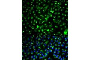 Immunofluorescence analysis of HeLa cells using CYP2E1 Polyclonal Antibody (CYP2E1 antibody)