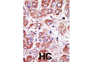 Immunohistochemistry (IHC) image for anti-Plasminogen Activator, Urokinase Receptor (PLAUR) antibody (ABIN3003728) (PLAUR antibody)