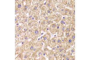 Immunohistochemistry of paraffin-embedded Human liver injury using ST3GAL3 antibody at dilution of 1:100 (x400 lens). (ST3GAL3 antibody)