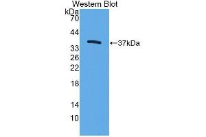 Western Blotting (WB) image for anti-Trefoil Factor 3 (Intestinal) (TFF3) antibody (Biotin) (ABIN1174902) (TFF3 antibody  (Biotin))
