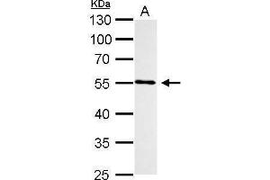 WB Image CYP1B1 antibody detects CYP1B1 protein by Western blot analysis. (CYP1B1 antibody  (Center))