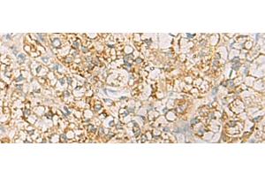 Immunohistochemistry (Paraffin-embedded Sections) (IHC (p)) image for anti-Major Histocompatibility Complex, Class II, DQ beta 2 (HLA-DQB2) antibody (ABIN7253932)