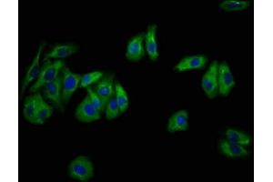 Immunofluorescence staining of HepG2 cells with ABIN7169579 at 1:133, counter-stained with DAPI. (Sialidase 4 antibody  (AA 225-377))