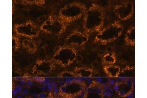 Immunofluorescence analysis of Rat kidney using SLC7A9 Polyclonal Antibody at dilution of 1:100. (SLC7A9 antibody)