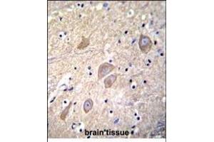 Immunohistochemistry (Paraffin-embedded Sections) (IHC (p)) image for anti-Visinin-Like 1 (VSNL1) (AA 47-75) antibody (ABIN656135)