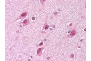 Image no. 1 for anti-HECT, UBA and WWE Domain Containing 1, E3 Ubiquitin Protein Ligase (HUWE1) (C-Term) antibody (ABIN302816) (HUWE1 antibody  (C-Term))