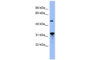 NIT1 antibody used at 1 ug/ml to detect target protein. (Nitrilase 1 antibody  (N-Term))