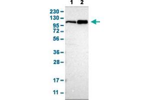 Western Blot analysis with CUL4B polyclonal antibody . (Cullin 4B antibody  (AA 9-152))