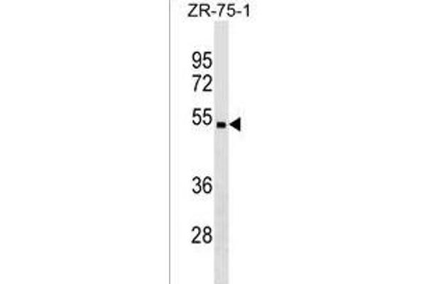 CHST5 antibody  (C-Term)