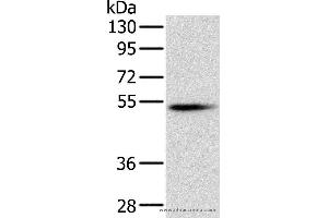 Western blot analysis of Mouse pancreas tissue, using PNLIP Polyclonal Antibody at dilution of 1:400 (PNLIP antibody)