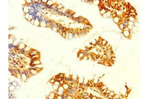 Immunohistochemistry of paraffin-embedded human small intestine tissue using ABIN7160672 at dilution of 1:100 (GALK2 antibody  (AA 161-458))