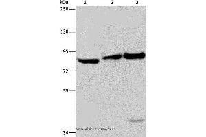 Western blot analysis of NIH/3T3 cell, mouse lung and liver tissue, using ECE1 Polyclonal Antibody at dilution of 1:550 (ECE1 antibody)