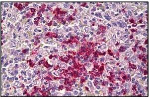 Human Spleen: Formalin-Fixed, Paraffin-Embedded (FFPE) (CDH23 antibody  (N-Term))