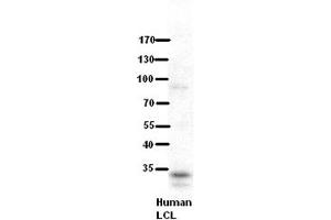 WB Suggested Anti-RRP1B Antibody Titration:  5% Milk  ELISA Titer:  dilution: 1:500  Positive Control:  human LCL (RRP1B antibody  (Middle Region))