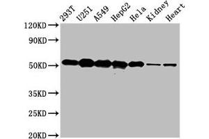 Western Blot Positive WB detected in: 293T whole cell lysate, U251 whole cell lysate, A549 whole cell lysate, HepG2 whole cell lysate, Hela whole cell lysate, Rat kidney tissue, Mouse heart tissue All lanes: SLC25A24 antibody at 5 μg/mL Secondary Goat polyclonal to rabbit IgG at 1/50000 dilution Predicted band size: 54, 52 kDa Observed band size: 54 kDa (SLC25A24 antibody  (AA 1-197))