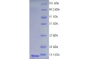 SDS-PAGE (SDS) image for Chemokine (C-C Motif) Receptor 5 (CCR5) (AA 263-354), (partial) protein (His tag) (ABIN5713330)