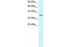 WB Suggested Anti-RPS16 Antibody Titration:  1. (RPS16 antibody  (Middle Region))