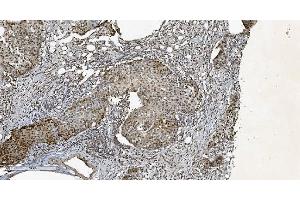 IHC analysis of HP1 alpha/CBX5 using anti-HP1 alpha/CBX5 antibody (ABIN7599057). (CBX5 antibody  (AA 1-191))