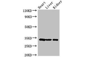 Western Blot Positive WB detected in: Mouse heart tissue, Mouse liver tissue, Mouse kidney tissue All lanes: CCND2 antibody at 3. (Cyclin D2 antibody  (AA 215-285))
