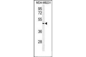 Western blot analysis of SMAD3 Antibody  in MDA-MB231 cell line lysates (35ug/lane).