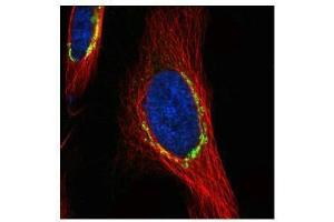 ICC/IF Image Confocal immunofluorescence analysis (Olympus FV10i) of paraformaldehyde-fixed HeLa, using COPD, antibody (green) at 1:500 dilution. (ARCN1 antibody)
