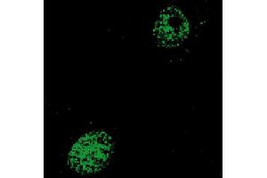 Alexander cells transfected with NR1H4  Primary Antibody: Anti-NR1H4 monoclonal (PA322-1. (NR1H4 antibody  (Isoform 2))