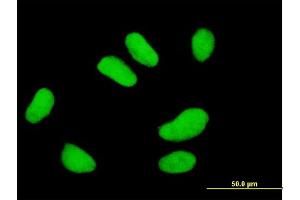 Immunofluorescence of monoclonal antibody to UBE2E2 on HeLa cell. (UBE2E2 antibody  (AA 1-201))