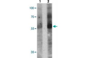 Western blot analysis of TOX in human colon tissue with TOX polyclonal antibody  at (1) 1 and (2) 2 ug/mL.