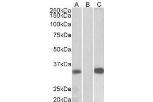 Western Blotting (WB) image for anti-Kv Channel Interacting Protein 3, Calsenilin (KCNIP3) (Internal Region) antibody (ABIN2465100) (DREAM antibody  (Internal Region))