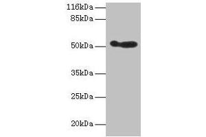 Western blot All lanes: ALDH3A1 antibody at 2 μg/mL + 293T whole cell lysate Secondary Goat polyclonal to rabbit IgG at 1/10000 dilution Predicted band size: 51 kDa Observed band size: 51 kDa (ALDH3A1 antibody  (AA 210-453))