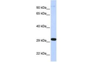 Image no. 1 for anti-Zinc Finger Protein 688 (ZNF688) (AA 72-121) antibody (ABIN6742728) (ZNF688 antibody  (AA 72-121))