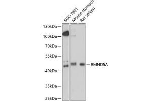 Western blot analysis of extracts of various cell lines, using RMND5A antibody (ABIN7269917) at 1:1000 dilution. (RMND5A antibody  (AA 200-270))