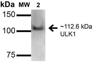 Western blot analysis of Human HeLa and 293Trap cell lysates showing detection of 112. (ULK1 antibody  (AA 567-577) (Biotin))