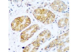 Immunohistochemistry of paraffin-embedded Human stomach using NCAM1 / CD56 Polyclonal Antibody at dilution of 1:100 (40x lens). (CD56 antibody)