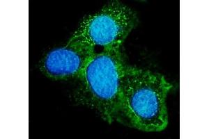 anti-ATP-Binding Cassette, Sub-Family G (WHITE), Member 8 (ABCG8) (AA 50-672) antibody