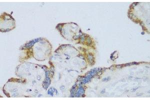 Immunohistochemistry of paraffin-embedded Human placenta using CYP11A1 Polyclonal Antibody at dilution of 1:150 (40x lens). (CYP11A1 antibody)