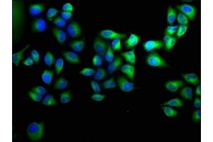 Immunofluorescence staining of Hela cells with ABIN7144218 at 1:100, counter-stained with DAPI. (ANKRD2 antibody  (AA 1-210))