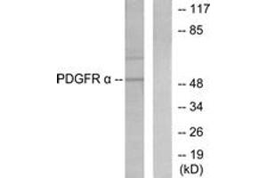 Western blot analysis of extracts from HepG2 cells, using Peripherin Antibody. (Peripherin antibody  (AA 421-470))