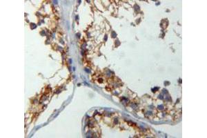 Used in DAB staining on fromalin fixed paraffin-embedded testis tissue (CRAT antibody  (AA 1-430))