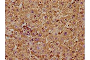 IHC image of ABIN7169187 diluted at 1:300 and staining in paraffin-embedded human liver tissue performed on a Leica BondTM system. (TAO Kinase 1 (TAOK1) (AA 400-659) antibody)