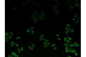 Detection of C1QBP in Hela cells using Polyclonal Antibody to Complement component 1 Q subcomponent-binding protein, mitochondrial (C1QBP) (C1QBP antibody  (AA 71-278))